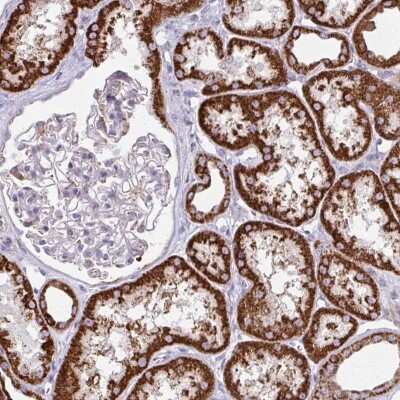 Immunohistochemistry-Paraffin: TVP23A Antibody [NBP2-32556] - Staining of human kidney shows strong cytoplasmic positivity in renal tubules.