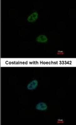 Immunocytochemistry/ Immunofluorescence TWA1 Antibody