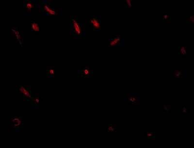 Immunocytochemistry/Immunofluorescence: TWA1 Antibody [NBP1-77366] - Immunofluorescence of TWA1 in rat brain tissue with TWA1 antibody at 20 ug/mL.