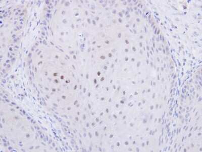 Immunohistochemistry-Paraffin: TWA1 Antibody [NBP1-32596] - Paraffin-embedded Cal27 xenograft, using antibody at 1:500 dilution.