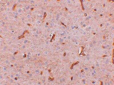 Immunohistochemistry-Paraffin: TWA1 Antibody [NBP1-77366] - TWA1 Antibody Rat brain tissue with C20orf11 antibody at 2.5 ug/ml.