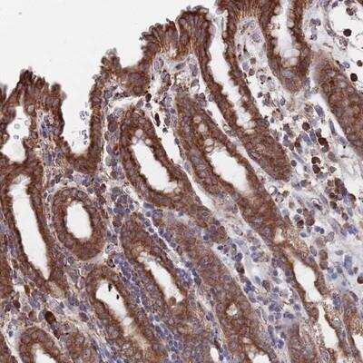 Immunohistochemistry-Paraffin TWA1 Antibody