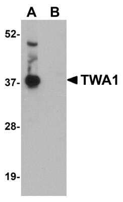 Western Blot TWA1 Antibody - BSA Free