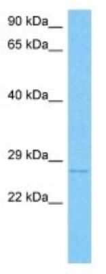 Western Blot: TWA1 Antibody [NBP3-10061] - Western blot analysis of TWA1 in Human ACHN Whole Cell lysates. Antibody dilution at 1ug/ml