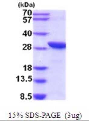 SDS-PAGE Recombinant Human TWA1 His Protein