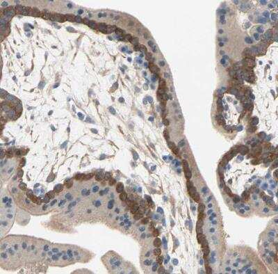 Immunohistochemistry-Paraffin: TWEAK R/TNFRSF12 Antibody [NBP1-85770] - Staining of human placenta shows moderate membranous positivity in trophoblastic cells.