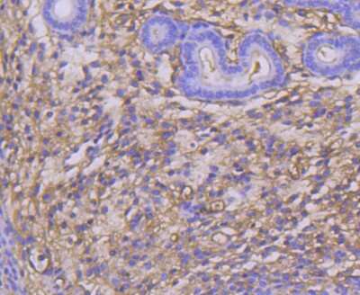 Immunohistochemistry-Paraffin: TWEAK R/TNFRSF12 Antibody (SN20-07) [NBP2-67729] - Analysis of paraffin-embedded mouse uterus tissue using anti-TWEAKR antibody. Counter stained with hematoxylin.
