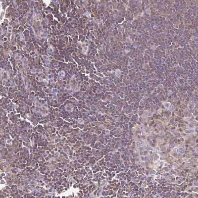 Immunohistochemistry-Paraffin: TWF2 Antibody [NBP2-47591] - Staining of human lymph node shows moderate cytoplasmic positivity in non-germinal center cells.