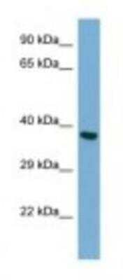 Western Blot: TWF2 Antibody [NBP1-98388] - HepG2 Cell Lysate 1.0ug/ml