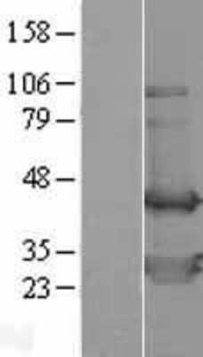 Western Blot TWF2 Overexpression Lysate