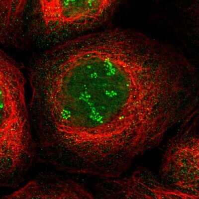 Immunocytochemistry/ Immunofluorescence TWISTNB Antibody