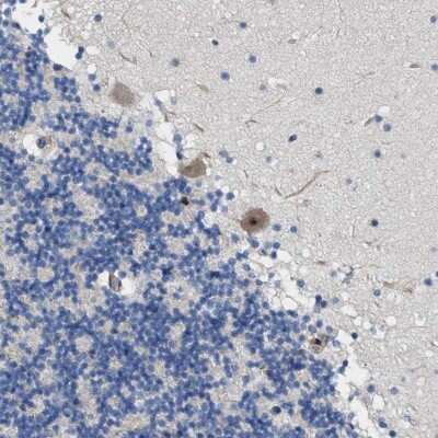 Immunohistochemistry-Paraffin: TWISTNB Antibody [NBP1-89454] - Staining of human cerebellum shows cytoplasmic and nucleolar positivity in Purkinje cells.