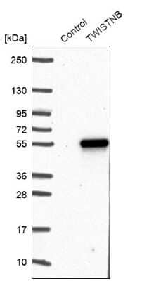 Western Blot TWISTNB Antibody