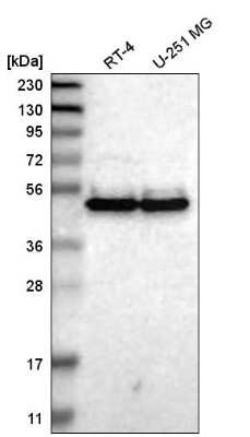 Western Blot: TWISTNB Antibody [NBP1-89454] - Analysis in human cell line RT-4 and human cell line U-251 MG.