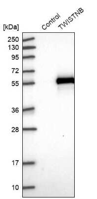 Western Blot: TWISTNB Antibody [NBP1-89454] - Analysis in control (vector only transfected HEK293T lysate) and TWISTNB over-expression lysate (Co-expressed with a C-terminal myc-DDK tag (3.1 kDa) in mammalian HEK293T cells).