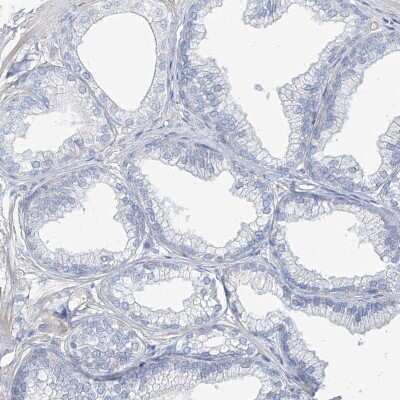 Immunohistochemistry-Paraffin: TXLNB Antibody [NBP2-33927] - Staining of human prostate shows low expression as expected.