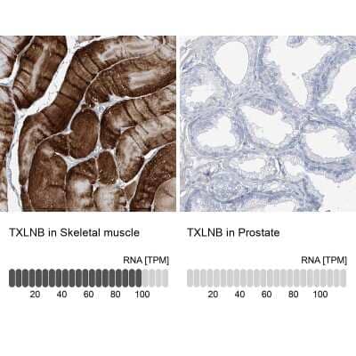 <b>Orthogonal Strategies Validation. </b>Immunohistochemistry-Paraffin: TXLNB Antibody [NBP2-33927] - Staining in human skeletal muscle and prostate tissues using anti-TXLNB antibody. Corresponding TXLNB RNA-seq data are presented for the same tissues.