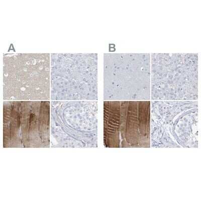 <b>Independent Antibodies Validation. </b>Immunohistochemistry-Paraffin: TXLNB Antibody [NBP2-33927] - Staining of human cerebral cortex, liver, skeletal muscle and testis using Anti-TXLNB antibody NBP2-33927 (A) shows similar protein distribution across tissues to independent antibody NBP2-33926 (B).