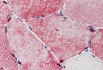 Immunohistochemistry-Paraffin: TXLNB Antibody [NBP3-14511] - Immunohistochemistry of formalin-fixed, paraffin-embedded human skeletal muscle after heat-induced antigen retrieval.