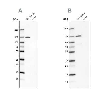 Western Blot: TXLNB Antibody [NBP2-33926] - Analysis NBP2-33926 (A) shows similar pattern to independent antibody NBP2-33927 (B).