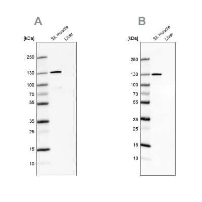 Western Blot: TXLNB Antibody [NBP2-33927] - Analysis NBP2-33927 (A) shows similar pattern to independent antibody NBP2-33926 (B).