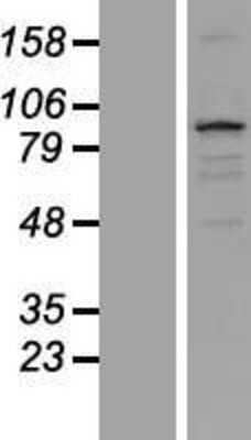 Western Blot: TXLNB Overexpression Lysate (Adult Normal) [NBP2-05277] Left-Empty vector transfected control cell lysate (HEK293 cell lysate); Right -Over-expression Lysate for TXLNB.