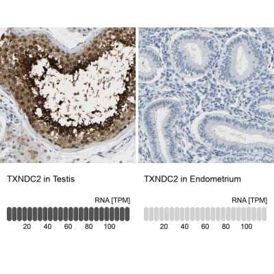 Immunohistochemistry-Paraffin TXNDC2 Antibody - BSA Free