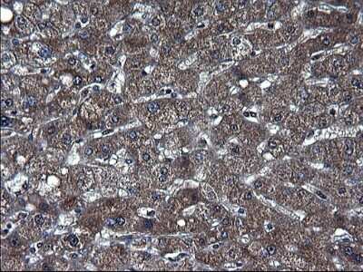 Immunohistochemistry-Paraffin: TXNDC5 Antibody (OTI2E6) [NBP2-46256] - Analysis of Human liver tissue. (Heat-induced epitope retrieval by 1 mM EDTA in 10mM Tris, pH8.5, 120C for 3min)