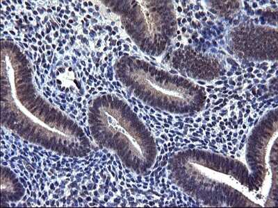 Immunohistochemistry-Paraffin: TXNDC5 Antibody (OTI2E6) [NBP2-46256] - Analysis of Human endometrium tissue. (Heat-induced epitope retrieval by 1 mM EDTA in 10mM Tris, pH8.5, 120C for 3min)