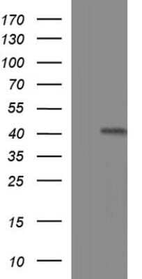 Western Blot: TXNDC5 Antibody (OTI2E6) [NBP2-46256] -  Analysis of HEK293T cells were transfected with the pCMV6-ENTRY control (Left lane) or pCMV6-ENTRY TXNDC5.