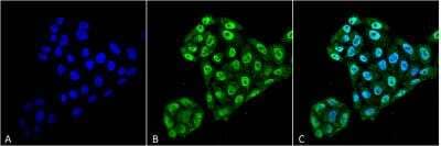 Immunocytochemistry/Immunofluorescence: TXNDC5 Antibody (2E7/7) [NBP2-22414] - Tissue: Cervical Cancer cell line (HeLa). Species: Human. Fixation: 4% Formaldehyde for 15 min at RT. Primary Antibody: Mouse Anti-EndoPDI Monoclonal Antibody at 1:100 for 60 min at RT. Secondary Antibody: Goat Anti-Mouse ATTO 488 at 1:100 for 60 min at RT. Counterstain: DAPI (blue) nuclear stain at 1:5000 for 5 min RT. Localization: Nucleus, Endoplasmic Reticulum, Endoplasmic Reticulum Lumen. Magnification: 60X.