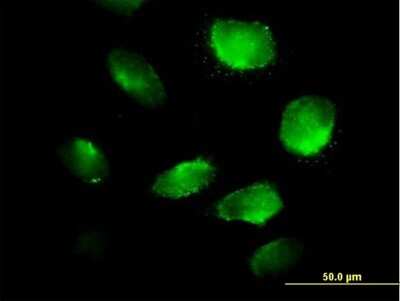 Immunocytochemistry/Immunofluorescence: TXNDC5 Antibody [H00081567-B01P] - Analysis of purified antibody to TXNDC5 on HeLa cell. (antibody concentration 10 ug/ml)