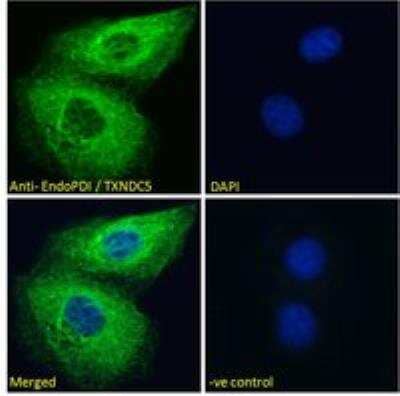 Immunocytochemistry/Immunofluorescence: TXNDC5 Antibody [NB100-1452] - Analysis of paraformaldehyde fixed HeLa cells, permeabilized with 0.15% Triton. Primary incubation 1hr (10 ug/mL) followed by Alexa Fluor 488 secondary antibody (2 ug/mL), showing endoplasmic reticulum staining. The nuclear stain is DAPI (blue). Negative control: Unimmunized goat IgG (10 ug/mL) followed by Alexa Fluor 488 secondary antibody (2 ug/mL).