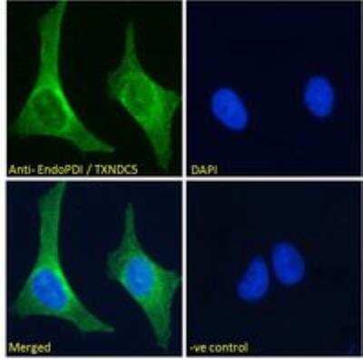 Immunocytochemistry/Immunofluorescence: TXNDC5 Antibody [NB100-1452] - Analysis of paraformaldehyde fixed U2OS cells, permeabilized with 0.15% Triton. Primary incubation 1hr (10 ug/mL) followed by Alexa Fluor 488 secondary antibody (2 ug/mL), showing endoplasmic reticulum staining. The nuclear stain is DAPI (blue). Negative control: Unimmunized goat IgG (10 ug/mL) followed by Alexa Fluor 488 secondary antibody (2 ug/mL).