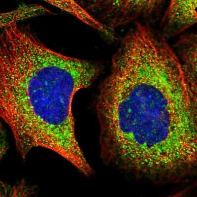 <b>Independent Antibodies Validation. </b>Immunocytochemistry/Immunofluorescence: TXNDC5 Antibody [NBP2-13497] - Staining of human cell line U-2 OS shows localization to endoplasmic reticulum.