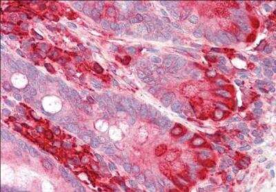 Immunohistochemistry-Paraffin: TXNDC5 Antibody [NB100-1452] - Staining of paraffin embedded Human Small Intestine. Antibody at 3.75 ug/mL. Steamed antigen retrieval with citrate buffer pH 6, AP-staining.