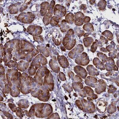 Immunohistochemistry-Paraffin: TXNDC5 Antibody [NBP2-13496] - Staining of human pancreas shows strong cytoplasmic positivity in exocrine glandular cells.