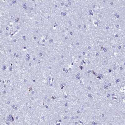 Immunohistochemistry-Paraffin: TXNDC5 Antibody [NBP2-13496] - Staining of human cerebral cortex shows low expression as expected.