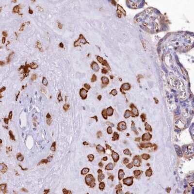 Immunohistochemistry-Paraffin: TXNDC5 Antibody [NBP2-13497] - Staining of human placenta shows cytoplasmic positivity in decidual cells.