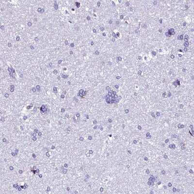 Immunohistochemistry-Paraffin: TXNDC5 Antibody [NBP2-13497] - Staining of human cerebral cortex shows low expression as expected.