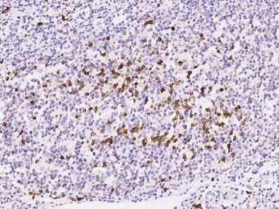 Immunohistochemistry-Paraffin: TXNDC5 Antibody [NBP2-98558] - Immunochemical staining of human TXNDC5 in human tonsil with rabbit polyclonal antibody at 1:5000 dilution, formalin-fixed paraffin embedded sections.