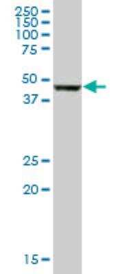Western Blot: TXNDC5 Antibody [H00081567-B01P] - TXNDC5 MaxPab polyclonal antibody. Western Blot analysis of TXNDC5 expression in human liver.