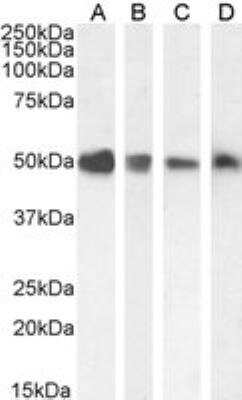 Western Blot TXNDC5 Antibody