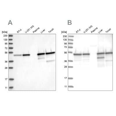 Western Blot: TXNDC5 Antibody [NBP2-13496] - Analysis using Anti-TXNDC5 antibody NBP2-13496 (A) shows similar pattern to independent antibody NBP2-13497 (B).