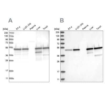 Western Blot: TXNDC5 Antibody [NBP2-13497] - Analysis using Anti-TXNDC5 antibody NBP2-13497 (A) shows similar pattern to independent antibody NBP2-13496 (B).