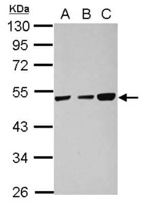 Western Blot: TXNDC5 Antibody [NBP2-20764] - Sample (30 ug of whole cell lysate) A: 293T B: HeLa C: HepG2 10% SDS PAGE gel, diluted at 1:1000.