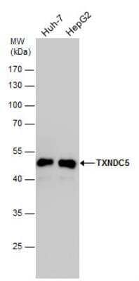 Western Blot: TXNDC5 Antibody [NBP2-20764] - TXNDC5 antibody detects TXNDC5 protein by western blot analysis. Various whole cell extracts (30 ug) were separated by 10% SDS-PAGE, and the membrane was blotted with TXNDC5 antibody diluted by 1:1000.