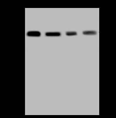 Western Blot: TXNDC5 Antibody [NBP2-98558] - Anti-TXNDC5 rabbit polyclonal antibody at 1:5000 dilution. Lane A: HepG2 Whole Cell Lysate Lane B: HeLa Whole Cell Lysate Lane C: HEK293 Whole Cell Lysate Lane D: 293T Whole Cell Lysate Lysates/proteins at 30 ug per lane. Secondary Goat Anti-Rabbit IgG (H+L)/HRP at 1/10000 dilution. Developed using the ECL technique. Performed under reducing conditions. Predicted band size: 48 kDa. Observed band size: 50 kDa