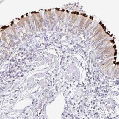 Immunohistochemistry: TXNDC6 Antibody [NBP2-48802] - Staining of human bronchus shows distinct positivity in cilia.