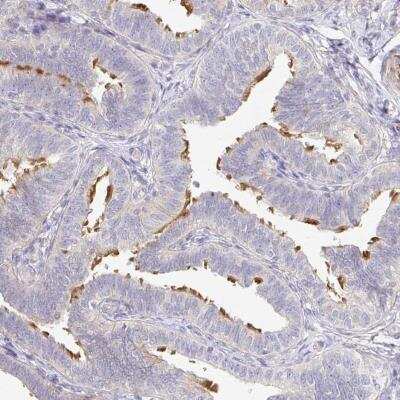 Immunohistochemistry-Paraffin: TXNDC6 Antibody [NBP2-48719] - Staining of human fallopian tube shows distinct positivity in glandular cells.